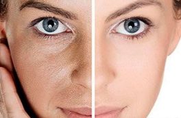 تیپ پوست تان را میشناسید؟