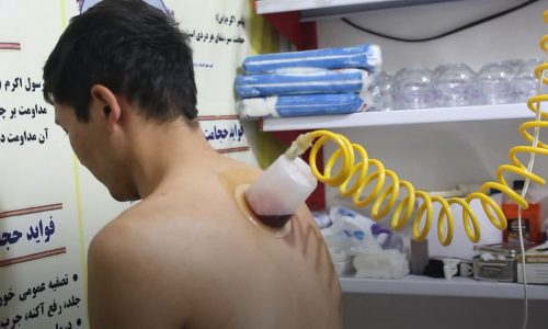 حجامت‌ چه بیماری‌هایی را درمان می‌کند؟